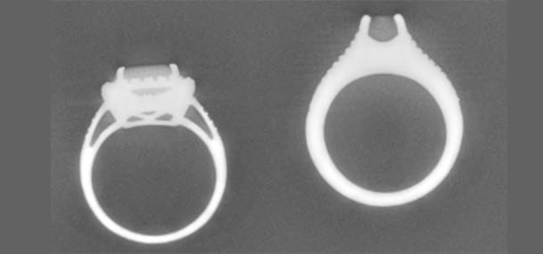 5a_rings-side-xray