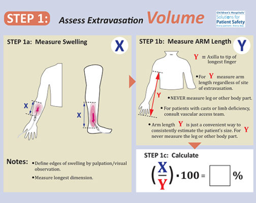 20150111_peripheral intravenous (piv) extravasation grading scal