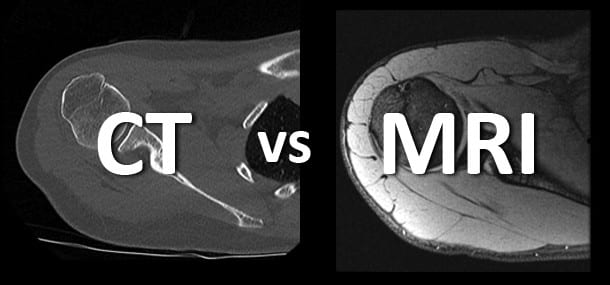CT vs MRI
